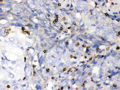 2 - Anti-ABL2 Picoband Antibody ABO12598
