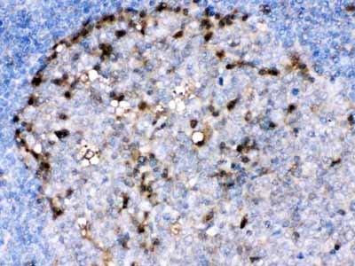 2 - Anti-ADA Picoband Antibody ABO12599