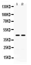 1 - Anti-ADA Picoband Antibody ABO12599