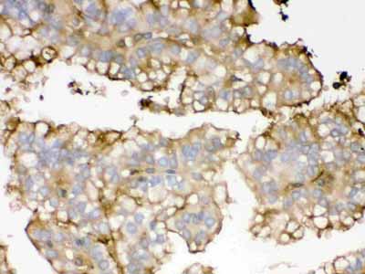 2 - Anti-APOA1 Picoband Antibody ABO12601