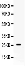 1 - Anti-APOA1 Picoband Antibody ABO12601