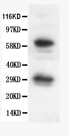 1 - Anti-Bcl-X Picoband Antibody ABO12602