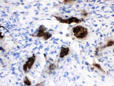 2 - Anti-Osteocalcin Picoband Antibody ABO12603