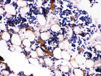 2 - Anti-Osteocalcin Picoband Antibody ABO12604