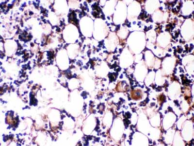 2 - Anti-Osteocalcin Picoband Antibody ABO12605