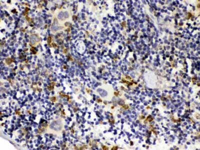 2 - Anti-GC1q R Picoband Antibody ABO12606