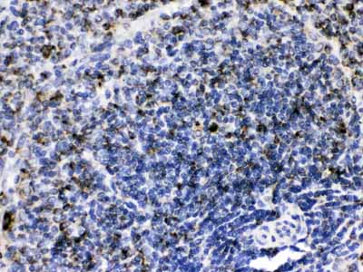 2 - Anti-GC1q R Picoband Antibody ABO12606