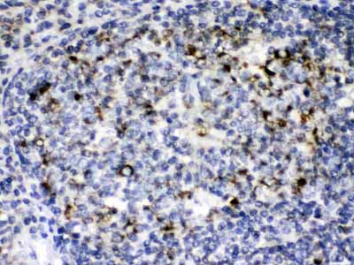 2 - Anti-GC1q R Picoband Antibody ABO12606