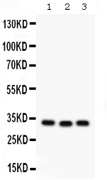 1 - Anti-GC1q R Picoband Antibody ABO12606