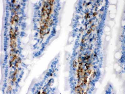 2 - Anti-Caldesmon Picoband Antibody ABO12607