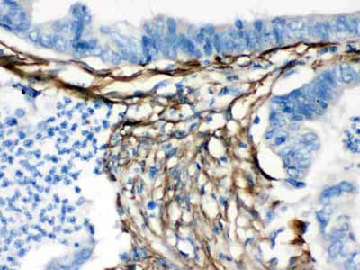 2 - Anti-Caldesmon Picoband Antibody ABO12607