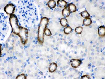 2 - Anti-CASR Picoband Antibody ABO12609