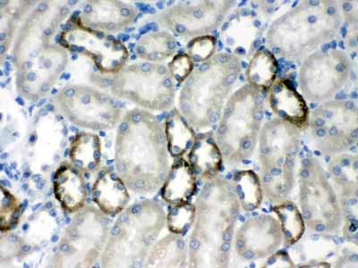 2 - Anti-CASR Picoband Antibody ABO12609