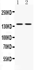 1 - Anti-CASR Picoband Antibody ABO12609