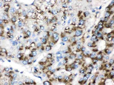 2 - Anti-Catalase Picoband Antibody ABO12610