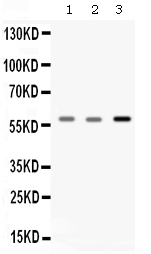 1 - Anti-Catalase Picoband Antibody ABO12610