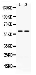 1 - Anti-CCT3 Picoband Antibody ABO12611