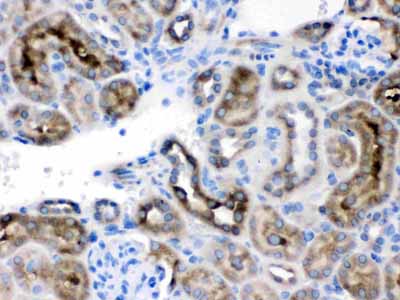 2 - Anti-TCP1 delta Picoband Antibody ABO12612