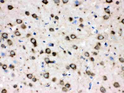 2 - Anti-TCP1 delta Picoband Antibody ABO12612