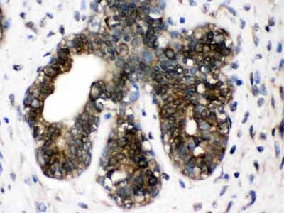 2 - Anti-TCP1 delta Picoband Antibody ABO12612