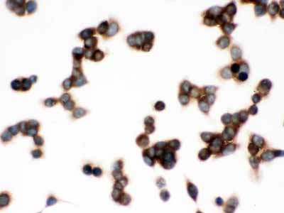 2 - Anti-TCP1 delta Picoband Antibody ABO12612
