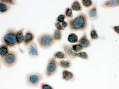 2 - Anti-TCP1 delta Picoband Antibody ABO12612