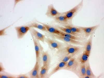 2 - Anti-TCP1 delta Picoband Antibody ABO12612