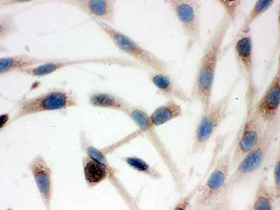 2 - Anti-TCP1 delta Picoband Antibody ABO12612