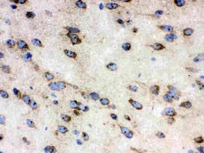 2 - Anti-TCP1 delta Picoband Antibody ABO12612