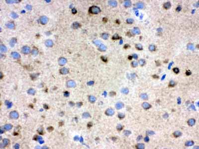 2 - Anti-TCP1 delta Picoband Antibody ABO12612