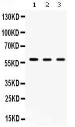 1 - Anti-TCP1 delta Picoband Antibody ABO12612