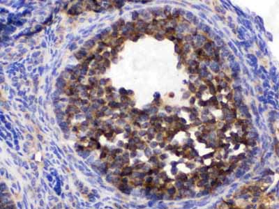 2 - Anti-TCP1 epsilon Picoband Antibody ABO12613