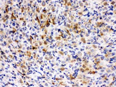 2 - Anti-TCP1 epsilon Picoband Antibody ABO12613