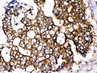 2 - Anti-TCP1 epsilon Picoband Antibody ABO12613
