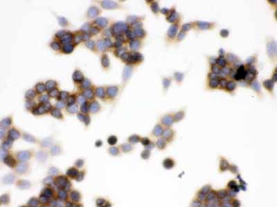 2 - Anti-TCP1 epsilon Picoband Antibody ABO12613