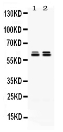 1 - Anti-TCP1 epsilon Picoband Antibody ABO12613