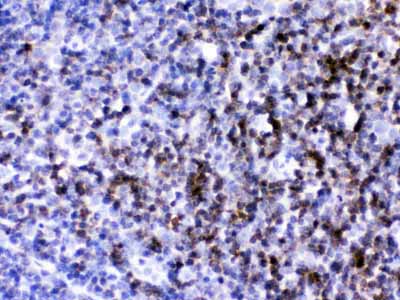 2 - Anti-CD2 Picoband Antibody ABO12614