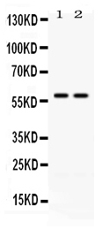 1 - Anti-CD2 Picoband Antibody ABO12614
