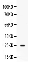 1 - Anti-CD9 Picoband Antibody ABO12615