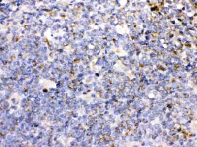 2 - Anti-TNFRSF7/CD27 Picoband Antibody ABO12616