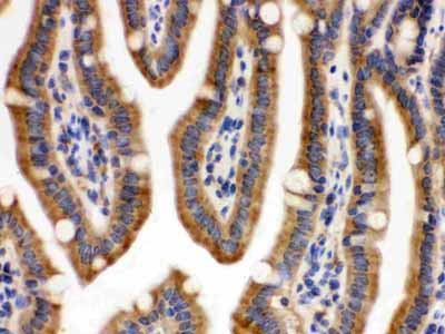 2 - Anti-CDCP1 Picoband Antibody ABO12618