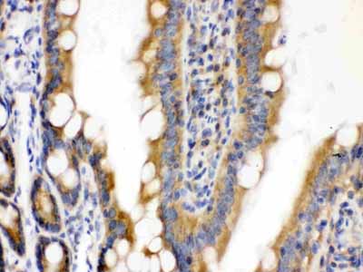 2 - Anti-CDCP1 Picoband Antibody ABO12618
