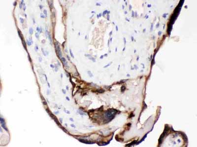 2 - Anti-CDCP1 Picoband Antibody ABO12618