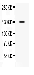 1 - Anti-CDCP1 Picoband Antibody ABO12618