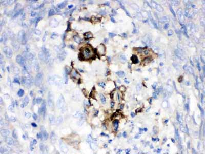 2 - Anti-Factor B Picoband Antibody ABO12619