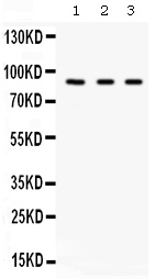 1 - Anti-Factor B Picoband Antibody ABO12619