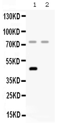 1 - Anti-Factor I Picoband Antibody ABO12620