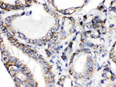2 - Anti-Calcitonin Picoband Antibody ABO12621