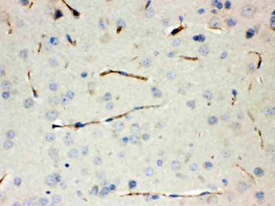 2 - Anti-Calcitonin Picoband Antibody ABO12622