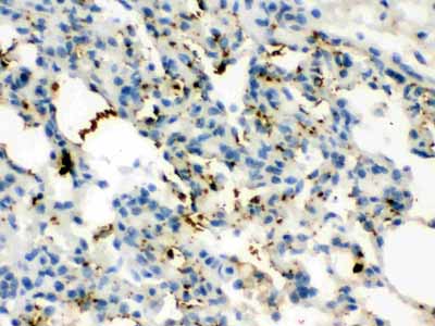2 - Anti-Calcitonin Picoband Antibody ABO12622